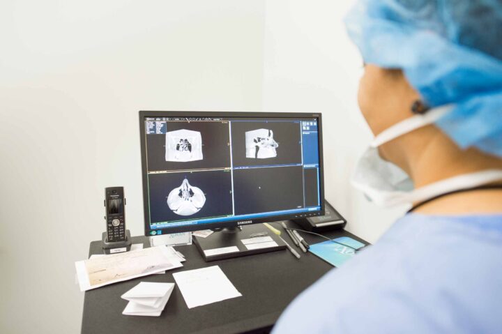 balloon sinuplasty florida, diagnose chronic sinusitis, nasal cavity